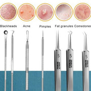 8pcs Ultra-fine Beauty Salon Acne Needle Tool Set displayed with tools for blackheads, acne, pimples, and comedones.