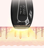 Home Laser Hair Removal 